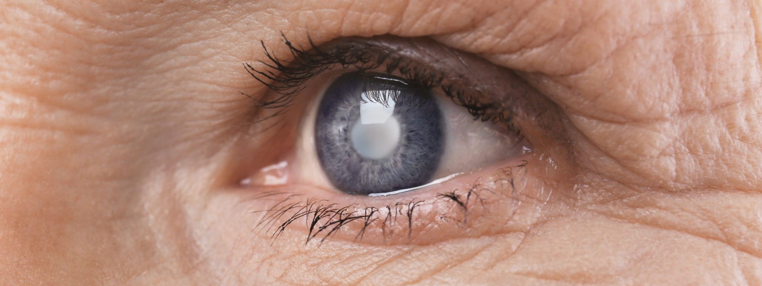 Причины катаракты