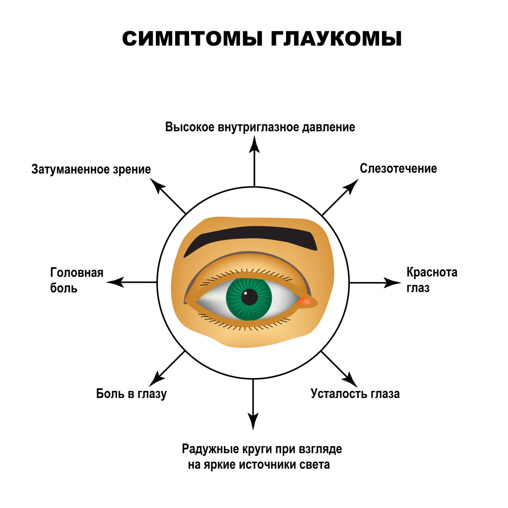 Симптомы глаукомы